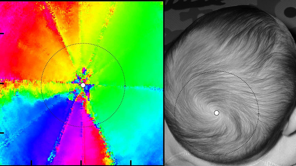 Scientist created a swirl around a central point (white dot) in the quantum state of atoms (left), akin to a whorl of hair on a baby’s head (right). (Credit: Ana Valdes/JQI)